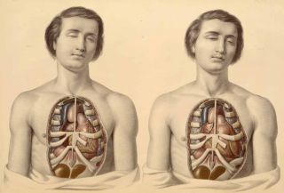 Disection Human Chest Cavity Autopsy Vintage 13x19 Print Reproduction