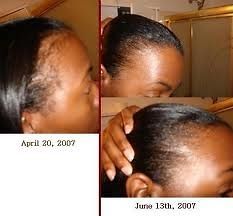 REJUVENATE POTENT JAMAICAN BLACK CASTOR OIL for Traction Alopecia